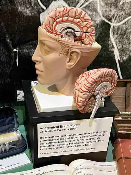 Anatomical brain model on display. Acquired neurodivergent is the term for neurodivergence that results from injury to the brain.
